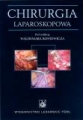 Chirurgia laparoskopowa
